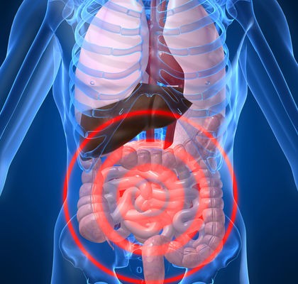 Test CE/IVD per marker di patologie intestinali di difficile interpretazione