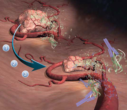 RELIATECH: Angiogenesi e Linfoangiogenesi